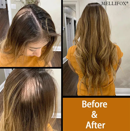 🔥 Each Only $1.49 Today🎁 Mellifox® Virgin Human Hair Seamless Tape-In Extensions